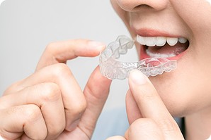 歯科矯正が保険適用になるのはいつから？保険適用条件や注意点を解説